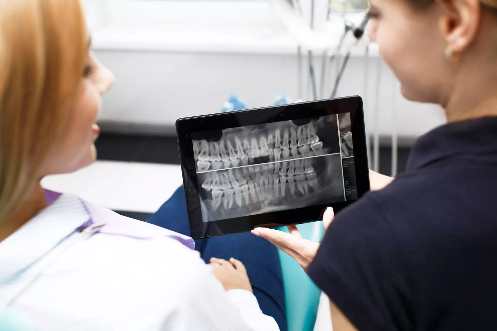 Dental Digital X-Ray (RVG)