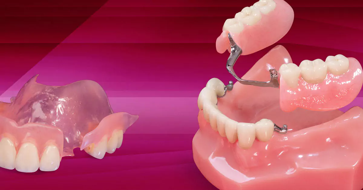 Partial Dentures